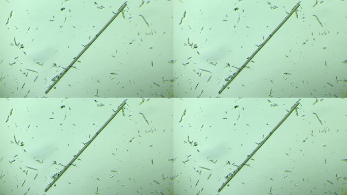 显微镜下放大100倍的微生物颤蓝细菌