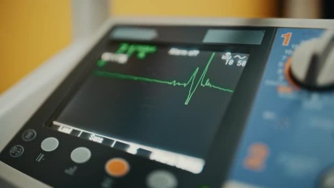 生命体征监视器在数字显示器上显示心率和其他医疗参数。病人的生命体征在医院的屏幕上。重症监护病房的心电