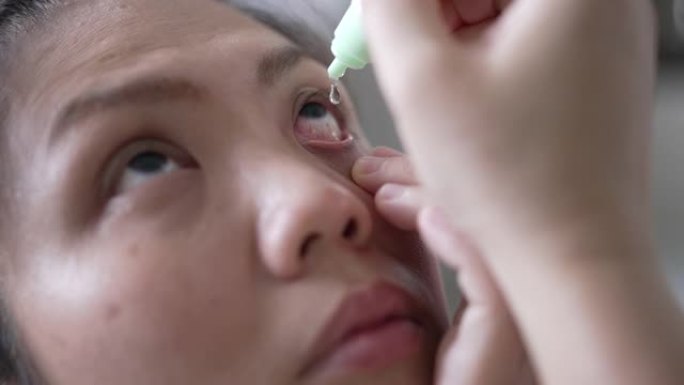 使用眼药水的女人展示眼药水眼珠