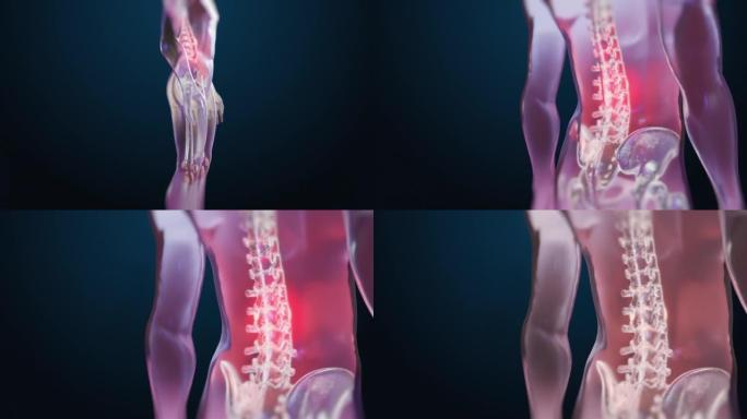 VFX背痛虚拟现实演示渲染。因脊柱创伤或关节炎而感到不适的人。示意性医学可视化。