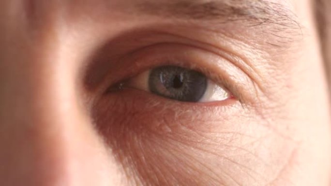 蓝眼睛的人紧张地眨眼。当他正在做眼科检查时，他可能会感到不安，并害怕自己可能会失败。他的学生又小又黑