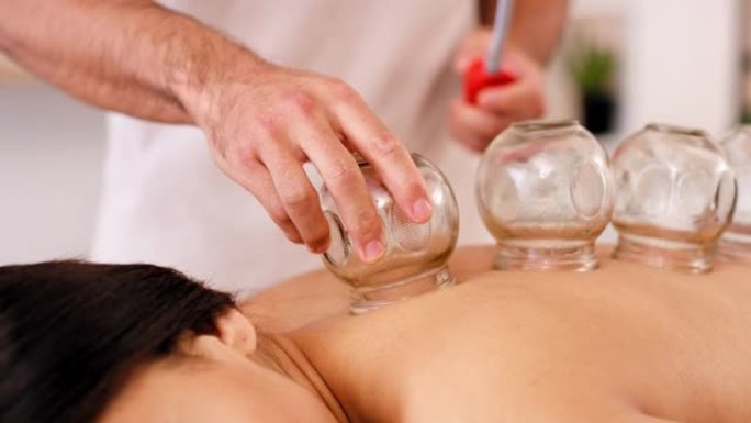 水疗，玻璃和拔罐疗法用于背部疼痛，通过物理疗法治疗和放松身体和背部肌肉。治疗师和女性患者在床上进行深