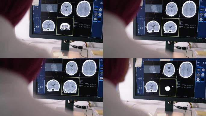 医生在控制室的计算机屏幕上检查ct扫描图像