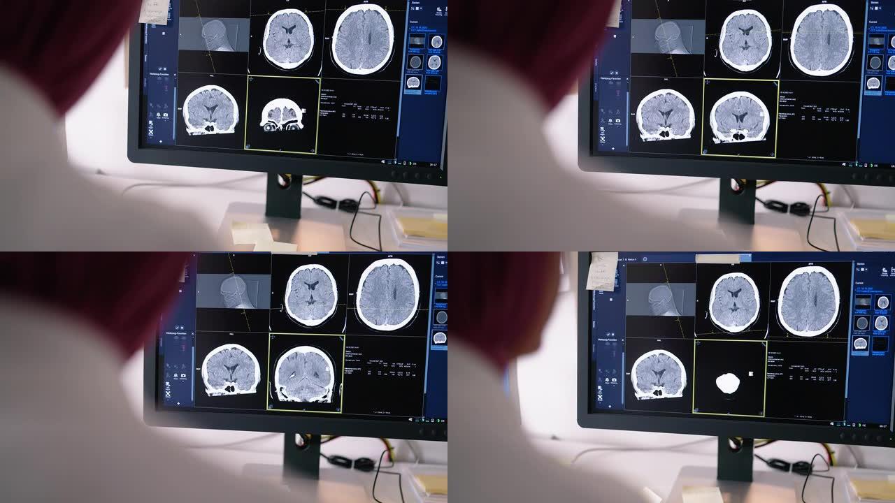 医生在控制室的计算机屏幕上检查ct扫描图像
