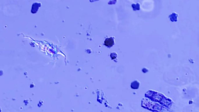 显微镜跟随游动的微生物