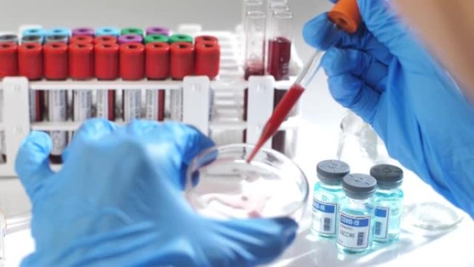 科学家在实验室研究血液样本。特写