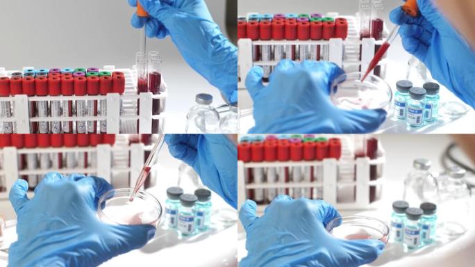 科学家在实验室研究血液样本。特写