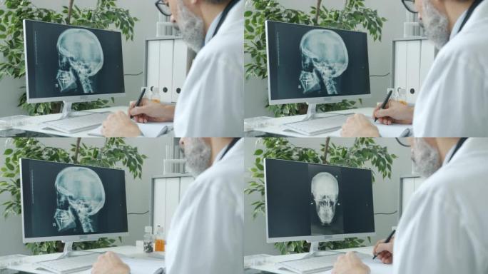 放射科医生分析人体颅骨图像，看着计算机屏幕并在医院室内观看