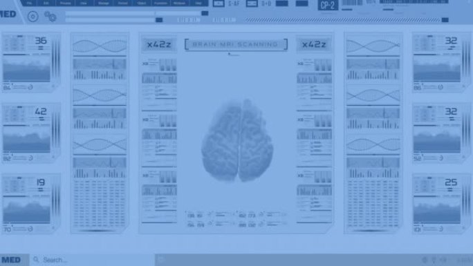 未来的数字医疗小组，带有用于分析患者大脑活动的系统。