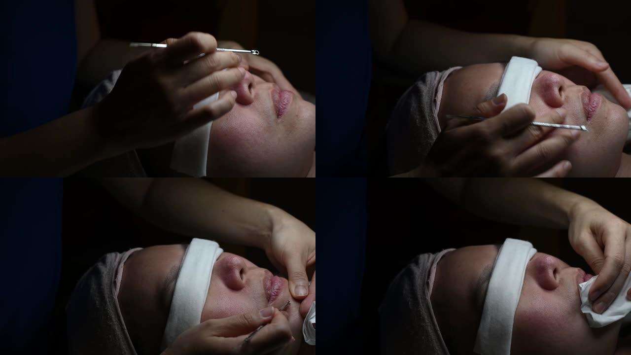 在面部美容院接受痤疮面部治疗的亚洲中国女性