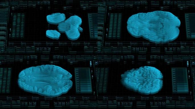 具有人脑Mri 3d可视化的未来医学hud界面。医学将能够创造一种虚拟的人的个性，这种个性会像爬行动