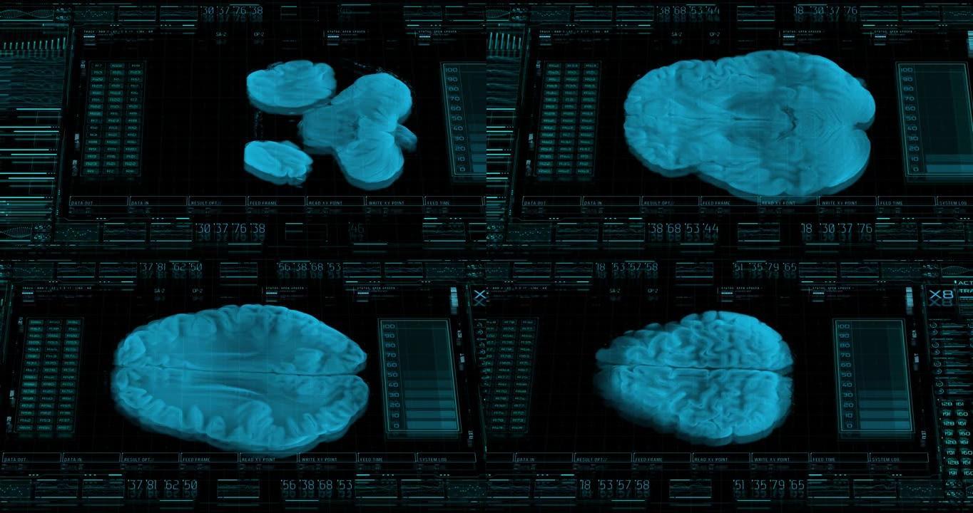 具有人脑Mri 3d可视化的未来医学hud界面。医学将能够创造一种虚拟的人的个性，这种个性会像爬行动