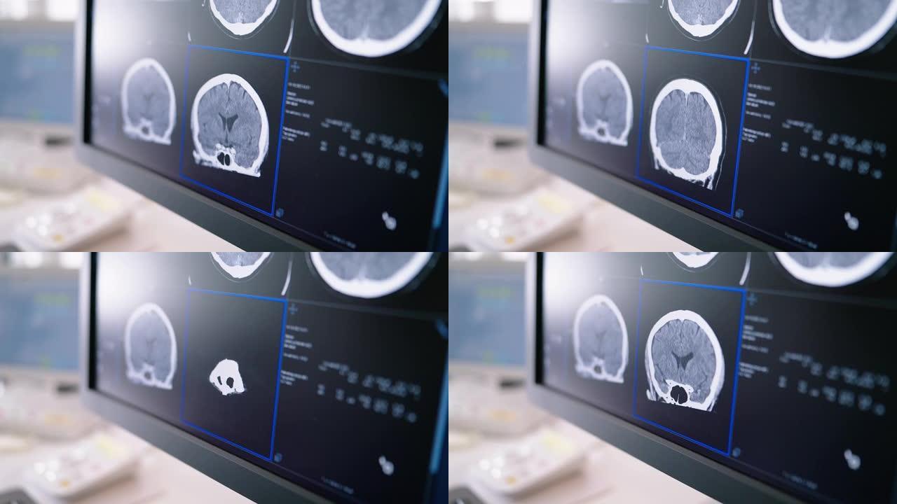 CAT在控制室的计算机屏幕上扫描图像