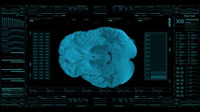高科技屏幕以3D方式显示大脑，并通过神经内科的统计数据监视其生命体征