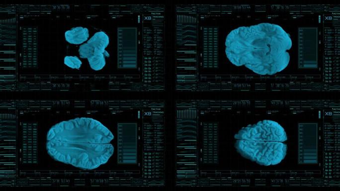 高科技屏幕以3D方式显示大脑，并通过神经内科的统计数据监视其生命体征