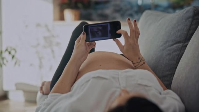 DS孕妇看着未出生婴儿的超声波扫描