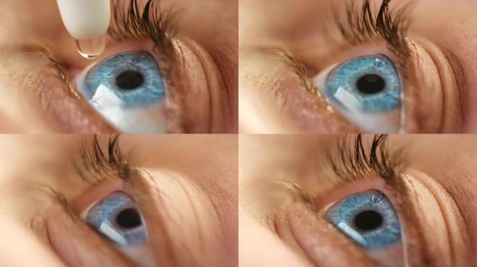 眼药水，药物和眼睛健康的视力支持，眼睛疲劳安全和过敏。打开蓝色虹膜变焦的人使用健康的液体药物放松和平