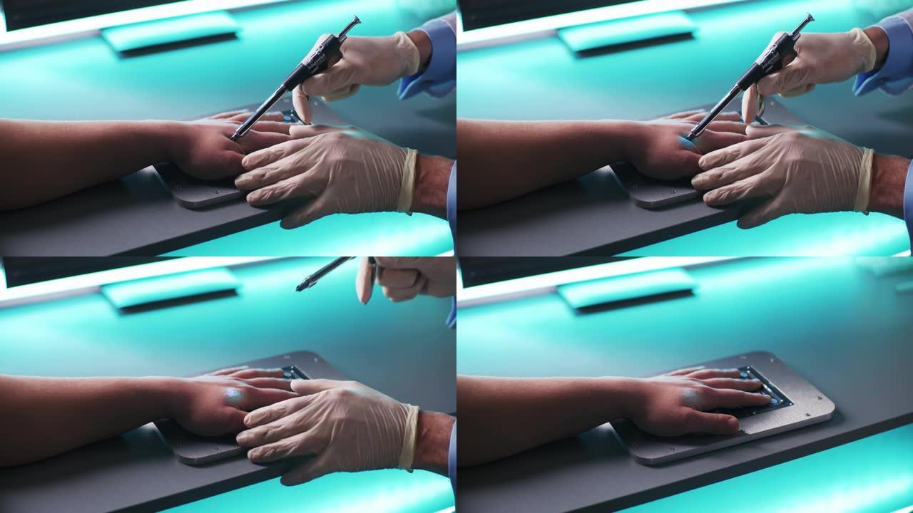 作物医生将RFID芯片注入患者手中