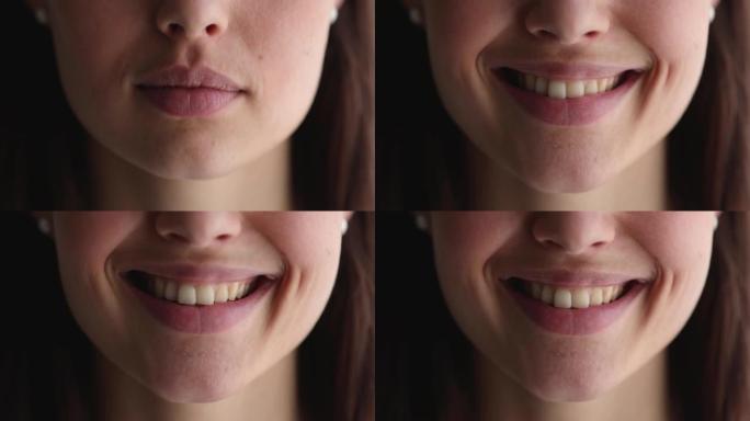 拥有健康完美洁白牙齿的微笑女人的特写脸