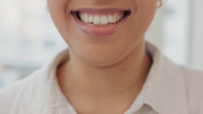 洁白的牙齿，一个笑的笑容和一个女孩在口服美白治疗后的特写镜头。一位年轻女子的嘴，脸上挂着灿烂的笑容，