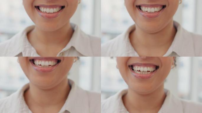 洁白的牙齿，一个笑的笑容和一个女孩在口服美白治疗后的特写镜头。一位年轻女子的嘴，脸上挂着灿烂的笑容，