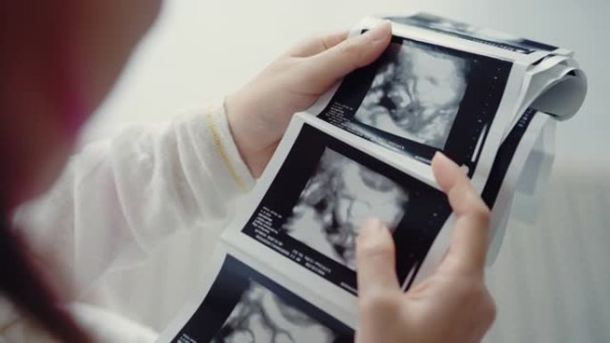 孕妇看着3D超声波扫描照片。
