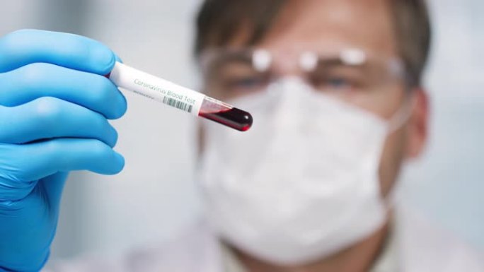 男性科学家正在观察血液样本