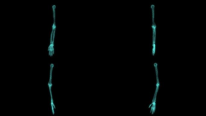 X射线扫描的人类手臂的数字增强视频片段