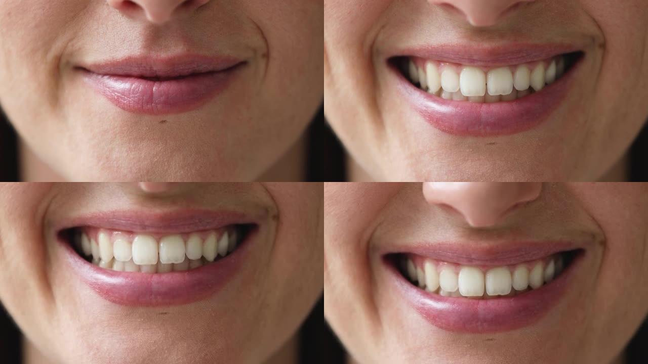 露齿微笑的女人在牙科服务上做广告，特写镜头