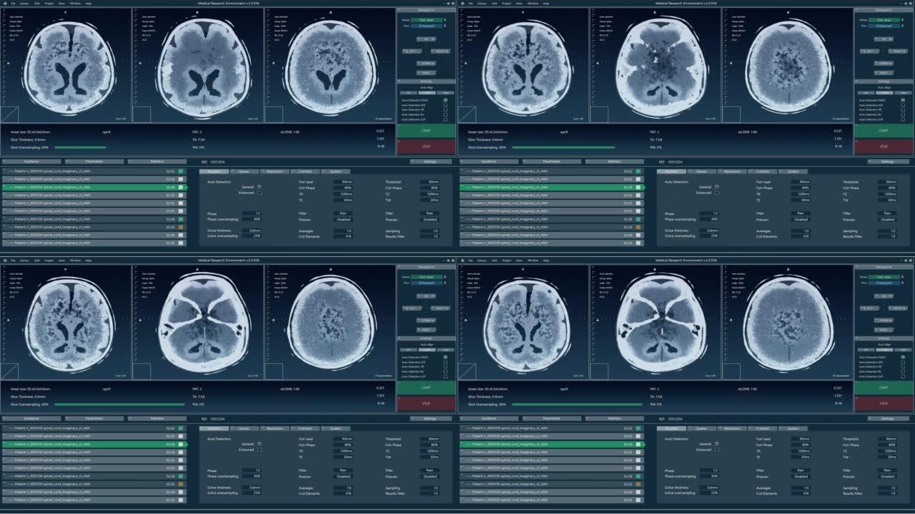 具有多个窗口和数据的磁共振成像脑扫描模型。具有用于计算机显示器和笔记本电脑屏幕的MRI结果的医学研究