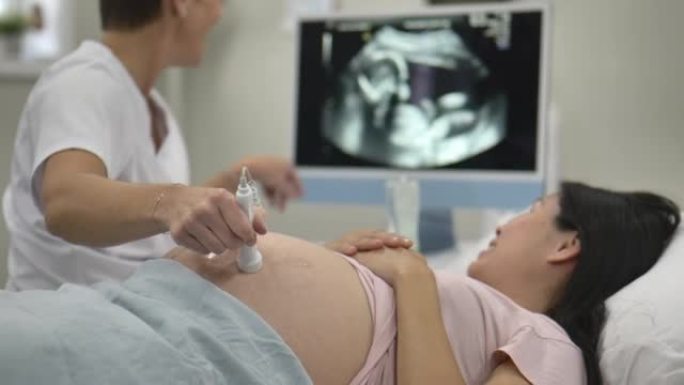 怀孕B超声波检查全身体检医院医疗外国医生