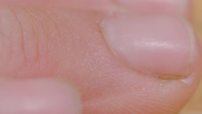 宏观: 一个努力工作的人的手指和指甲干裂的高度详细视图
