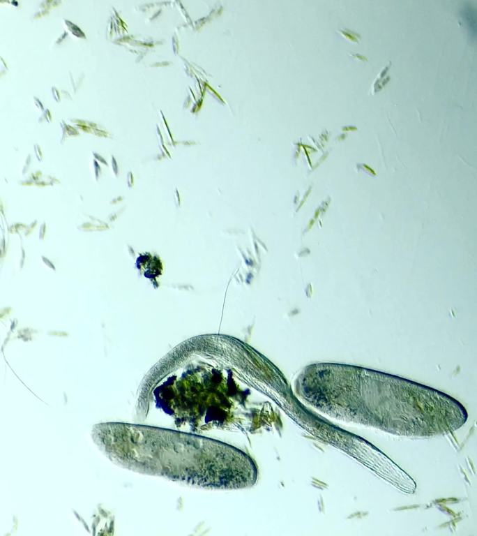 显微镜下放大100倍的草履虫和旋口虫