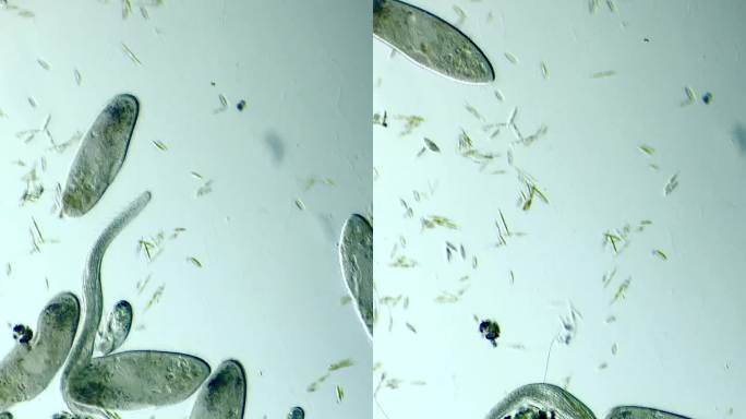 显微镜下放大100倍的草履虫和旋口虫