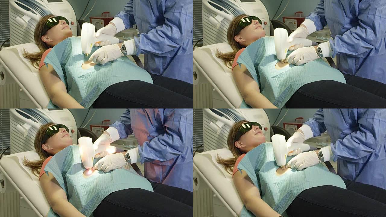 特写: 医生在病人身上使用激光医疗设备去除痣