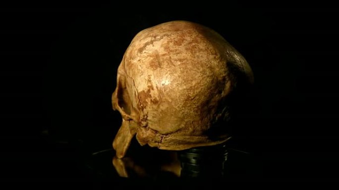 人类头骨骷髅考古医学