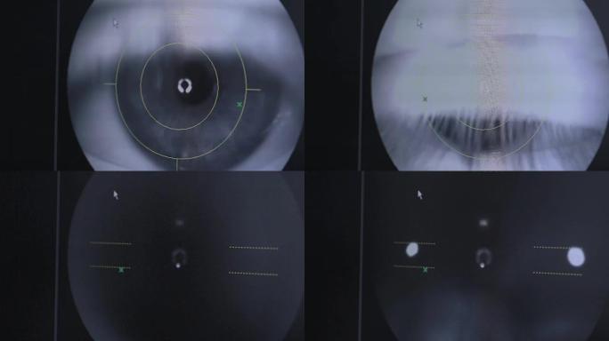 眼睛检查的特写。医生屏幕视图。在明亮的现代诊所的验光师就诊