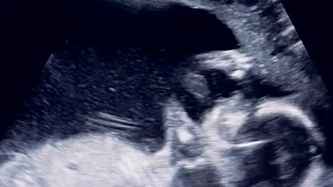 人类胎儿在母亲子宫中滚动的特写