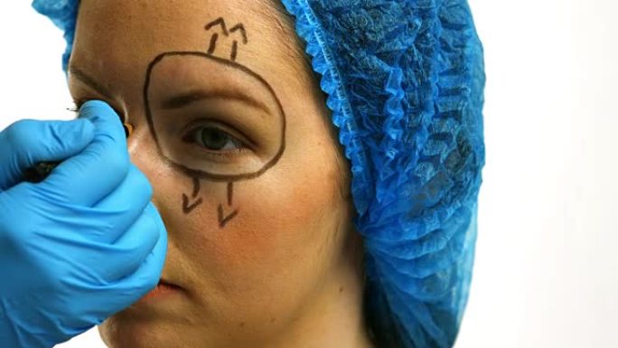 整形外科医生在女人的眼睛周围画