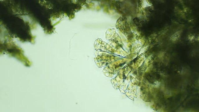 微生物，Vorticelas群