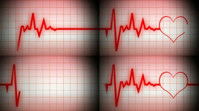 带形状的心脏监测仪心电图