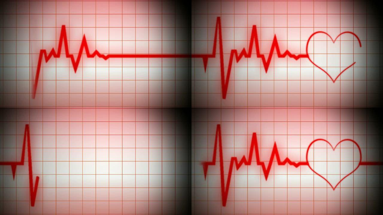 带形状的心脏监测仪心电图