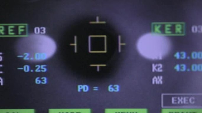 视力检查时用眼睛在屏幕上显示医疗现代化设备。特写