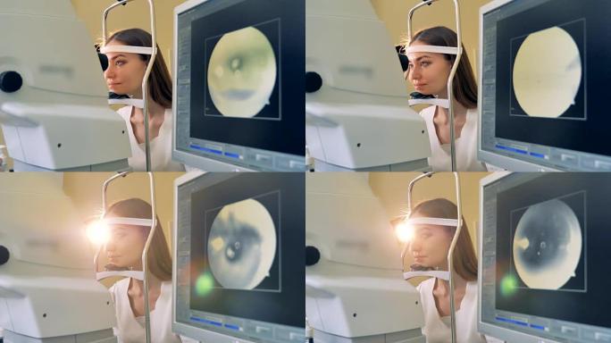 显示器上显示的女性视力的医学检查