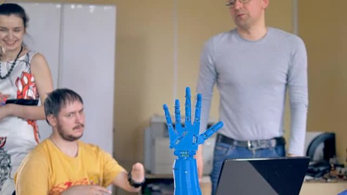 残疾人在截肢的手上使用无线传感器控制仿生手。
