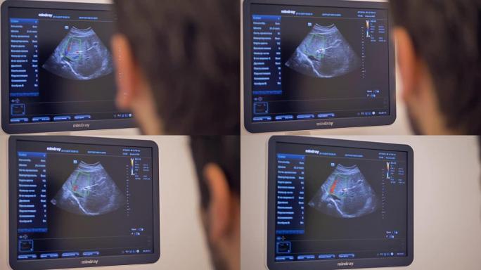 超声波机器监测器显示患者数据。