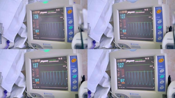 显示患者生命体征包括心率的医疗屏幕。