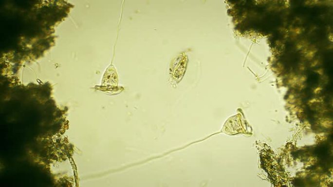微生物-Vorticella