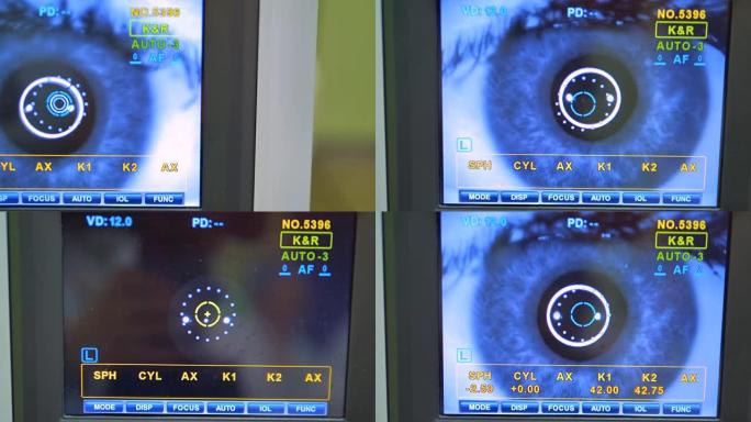 视网膜摄像机屏幕检查。