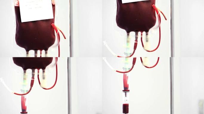 HD倾斜起重机镜头：输血